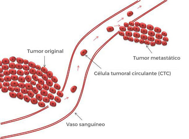 en un hemograma se detecta cancer